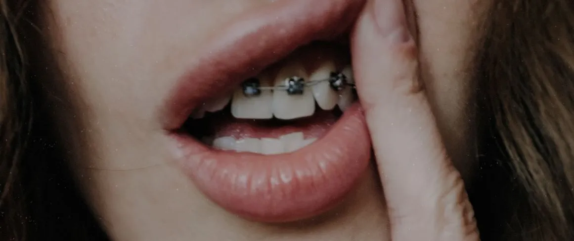 Teeth Cleaning in Al Ain