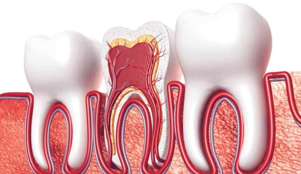Root Canal Treatment in Al Ain